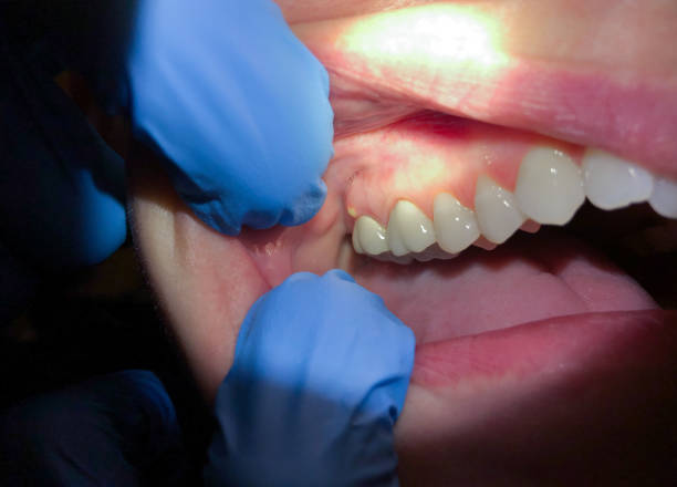 Best Broken or Cracked Tooth Emergency Dentist in Shinnecock Hills, NY